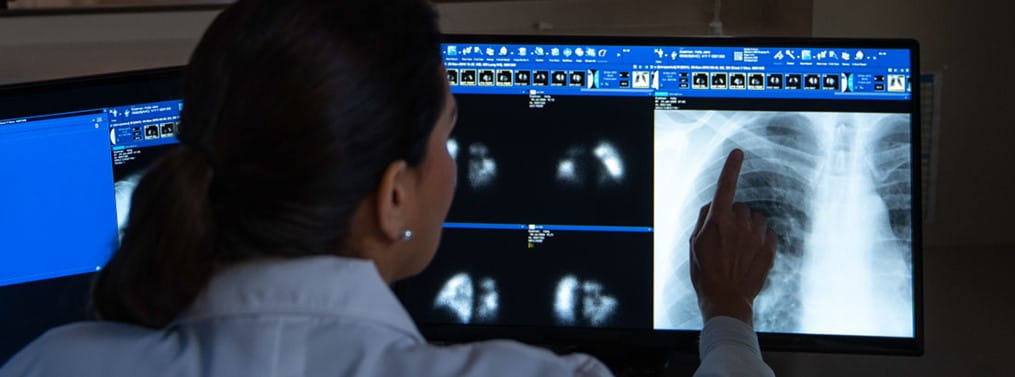 Pointing at X-ray Monitor